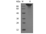 Recombinant Mouse LDLR protein (His tag)