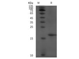 Recombinant Mouse Syndecan-4/Sdc4 protein (His tag)