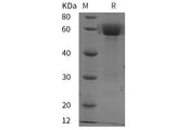 Recombinant Mouse DKK3 protein (His tag)