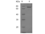 Recombinant Mouse Transferrin/TF protein (His tag)