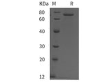 Recombinant Mouse Heparanase/HPA protein (His tag)