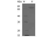 Recombinant Mouse Alpha-Fetoprotein/AFP protein (His tag)