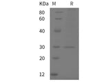 Recombinant Mouse CRP/C-Reactive protein (His tag)