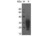 Recombinant Mouse Interleukin-13/IL-13 protein (His tag)