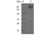 Recombinant Mouse ALCAM/CD166 protein (His tag)