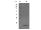 Recombinant Mouse IL10 protein (His tag)