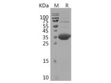 Recombinant Rabbit IL21 protein(His tag)