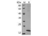 Recombinant Rabbit IL10 protein(His tag)