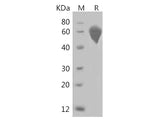 Recombinant Rat Syndecan-1/SDC1 Protein (His Tag)