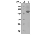 Recombinant Rat Ager protein(His tag)