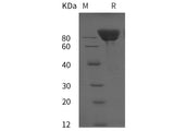 Recombinant Rat E-Cadherin/CDH1 Protein (His Tag)