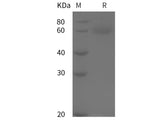 Recombinant Rat Antithrombin-III/Serpinc1 protein (His tag)