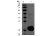 Recombinant Rat Interleukin-2/IL-2 Protein (His Tag)