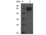 Recombinant Rat Angiotensinogen/AGT protein (His tag)