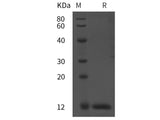 Recombinant Rat BMG/β2-MG protein (His tag)