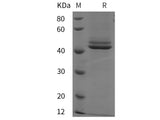 Recombinant Rat Interleukin-12 subunit beta/IL-12B protein (His tag)