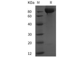 Recombinant Rat Vcam1 protein (His tag)