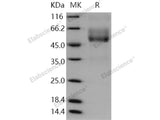 Recombinant Human Mucin-1/MUC-1 Protein (Fc Tag)