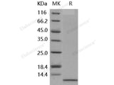 Recombinant Human IL-8/CXCL8 Protein (aa 23-99)