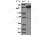 Recombinant Human GAD65/GAD2/GAD-2 Protein (GST Tag)