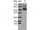 Recombinant Human CD16a/FCGR3A Protein (176 Val, His&AVI Tag), Biotinylated(Active)