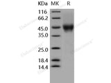 Recombinant Human CD16a/FCGR3A Protein (176 Val, His&AVI Tag)(Active)