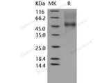 Recombinant Human CD16a/FCGR3A Protein (176 Phe, His&AVI Tag), Biotinylated(Active)