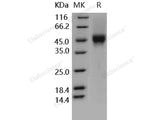 Recombinant Human CD16a/FCGR3A Protein (176 Phe, His&AVI Tag)(Active)