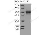 Recombinant Human CD16a/FCGR3A Protein (176 Val, His Tag)(Active)