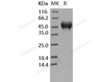 Recombinant Human CD16a/FCGR3A Protein (176 Phe, His Tag)(Active)