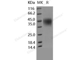 Recombinant Human CD16a/FCGR3A Protein (176 Val, His Tag)(Active)