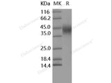 Recombinant Human CD16a/FCGR3A Protein (176 Phe, His Tag)