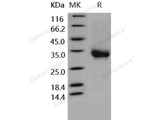 Recombinant Human CD32a/FCGR2A Protein (167 His, His&AVI Tag), Biotinylated(Active)