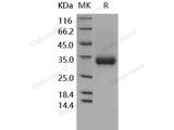 Recombinant Human CD32a/FCGR2A Protein (167 Arg, His&AVI Tag), Biotinylated(Active)