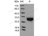 Recombinant Human CD32a/FCGR2A Protein (167 His, His Tag)(Active)