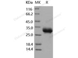 Recombinant Human CD32a/FCGR2A Protein (167 Arg, His Tag)(Active)