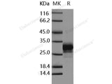 Recombinant Human CD32a/FCGR2A Protein (167 His, His Tag)(Active)