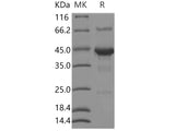 Recombinant Human SHISA3 Protein (Fc Tag)