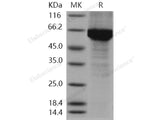 Recombinant Human HSP70/HSPA1A Protein (His Tag)(Active)