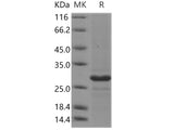 Recombinant Human CD20/MS4A1 Protein (TrxA Tag)