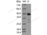 Recombinant Human Interleukin-18/IL-18 Protein (GST Tag)