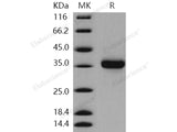 Recombinant Human KLK-8/Kallikrein-8 Protein (His Tag)(Active)