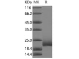 Recombinant Human CD16b/FCGR3B Protein, Biotinylated (Active)