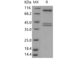 Recombinant Human AMPK (G1/B1/A2) Heterotrimer Protein (Active)