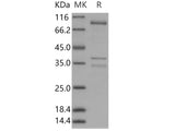 Recombinant Human AMPK (G1/B2/A1) Heterotrimer Protein (Active)