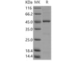 Recombinant Human SPHK1/Sphingosine Kinase 1 Protein (Active)