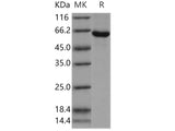 Recombinant Human SPHK1/Sphingosine Kinase 1 Protein (His&GST Tag)