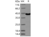 Recombinant Human ERK3/MAPK12 Protein