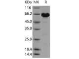 Recombinant Human ERK3/MAPK12 Protein (His & GST Tag)