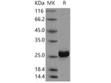 Recombinant Human CMPK1 Protein (His Tag)